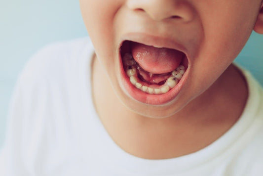 Rentrée : prévenir les caries liées aux écrans et encas - Nana Brush