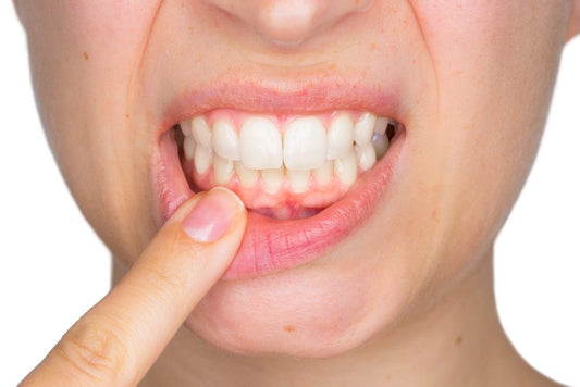 Les maladies liées à une mauvaise santé buccodentaire - Nana Brush
